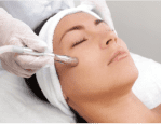 Laser treatment on women