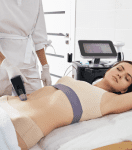 Morpheus8 Body Treatment